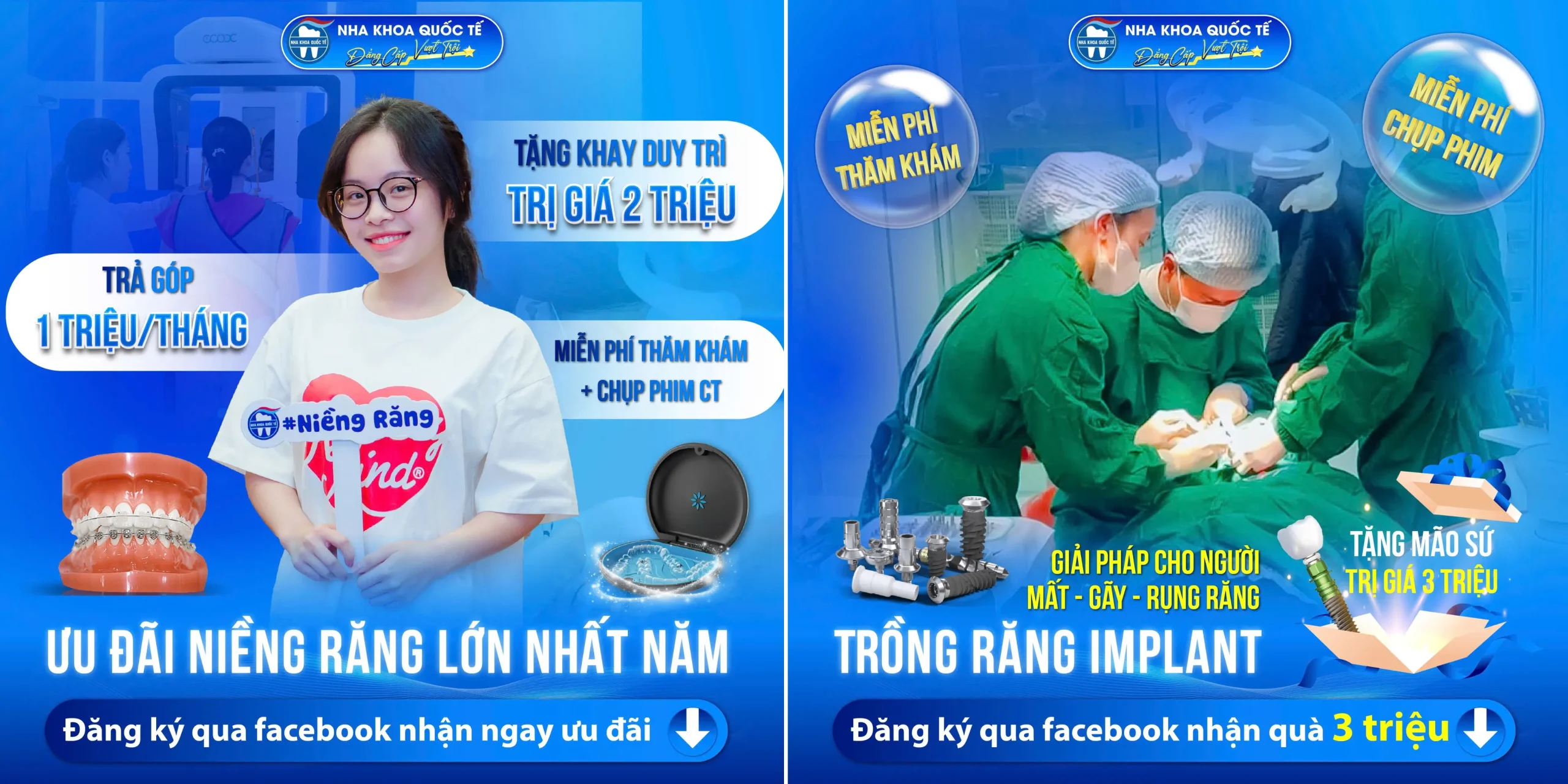 Khuyến mãi trồng imlant và niềng răng