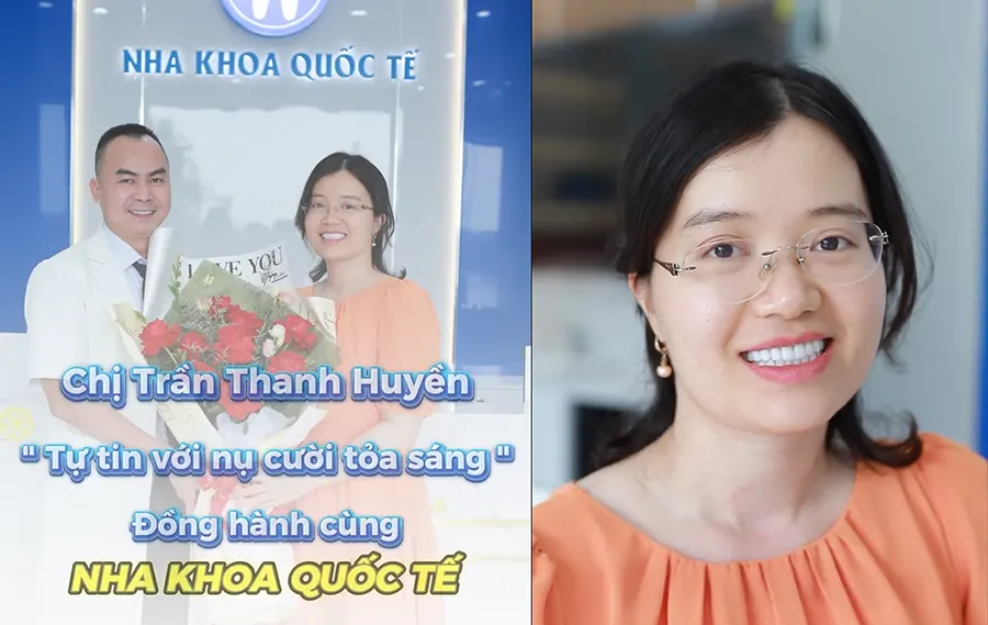 Cảm nhận khách hàng sau khi bọc răng sứ