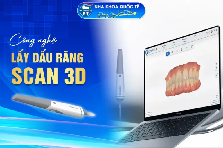 Công nghệ lấy dấu răng scan3d