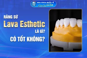Răng sứ Lava Esthetic