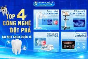 Top 4 công nghệ nha khoa