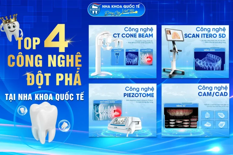 Top 4 công nghệ nha khoa