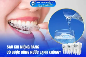 niềng răng được uống nước lạnh ko