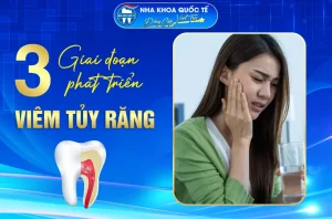 3 giai đoạn phát triển viêm tủy