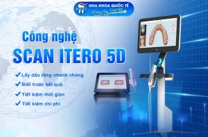 Công nghệ Scan itero 5d