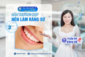 các trường hợp nên làm răng sứ