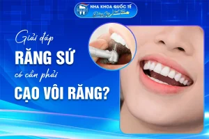 răng sứ có cần cạo vôi răng