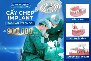 khuyến mãi trụ implant chỉ 900k
