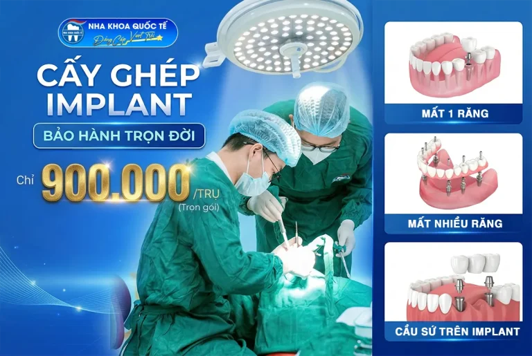 khuyến mãi trụ implant chỉ 900k