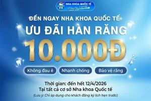 ưu đãi hàn răng