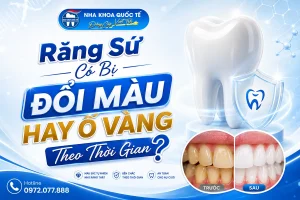 răng sứ bị ố vàng ko
