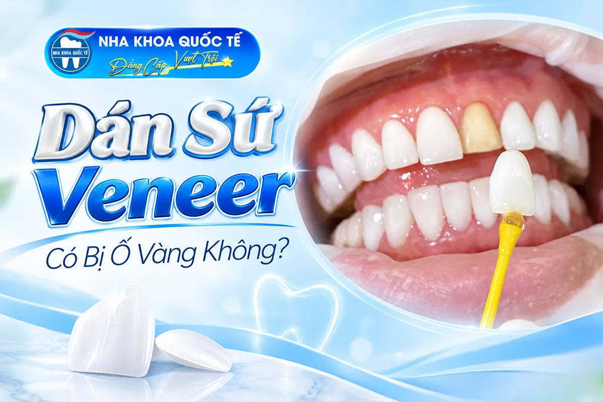 dán sứ có bị ố vàng ko